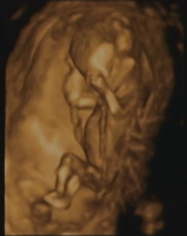 Baby Hocter at 14 Weeks